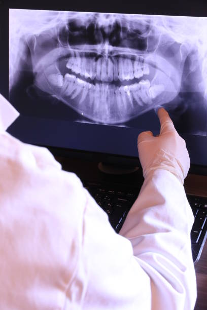 Best Broken or Cracked Tooth Emergency Dentist in South Haven, IN