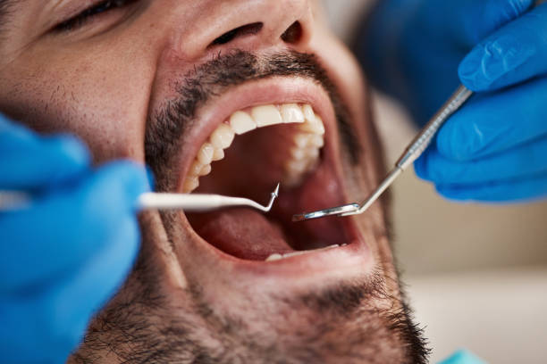 Best Urgent Dental Care for Toothache in South Haven, IN